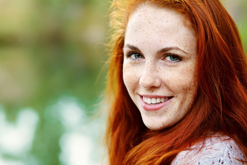 freckles freckle redhead removal eye creams skin cream being facts should rarest combination aging well why them adobe friend breakthrough