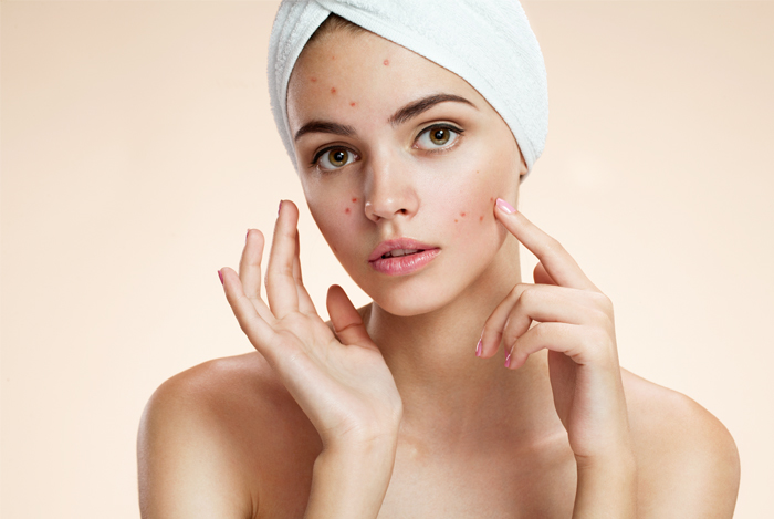 Top 10 Best Face Washes for Dealing with Acne in 2017 Reviewed