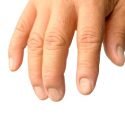 Brittle Nails Causes and Remedies