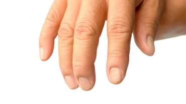 Brittle Nails Causes and Remedies
