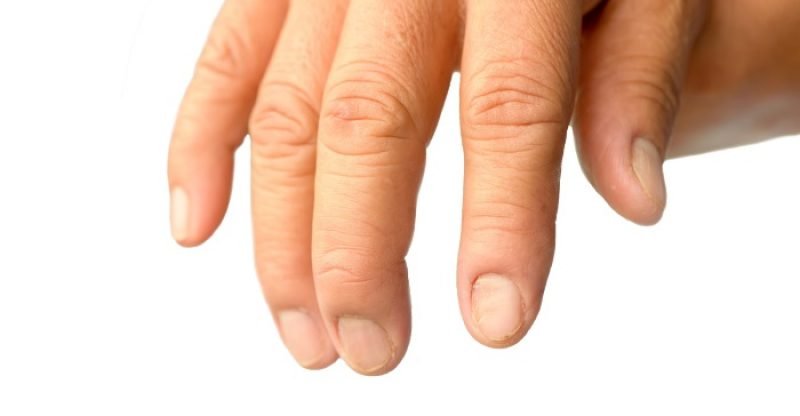 Brittle Nails Causes and Remedies