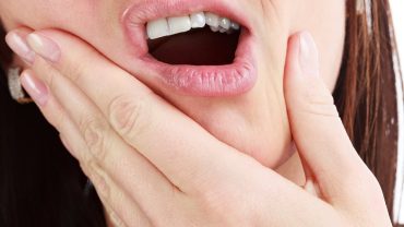 Gingivitis Symptoms