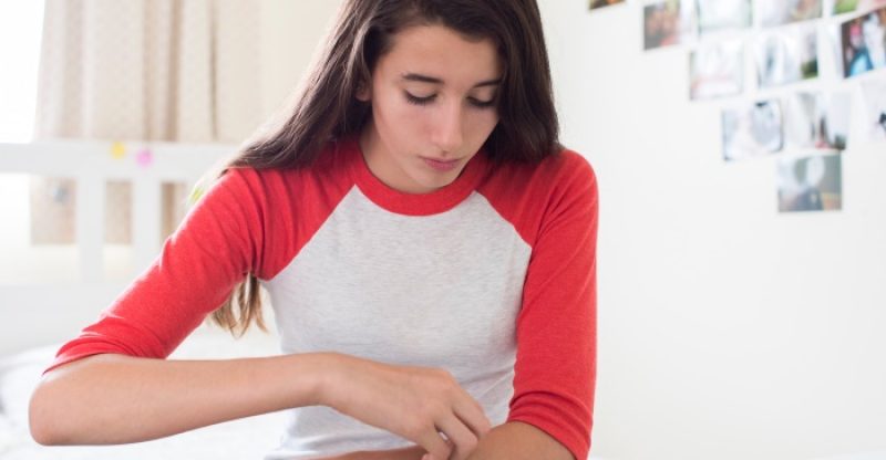 How-To-Get-Rid-of-Hives