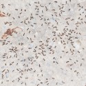 How to Get Rid of Ants Fast and Naturally