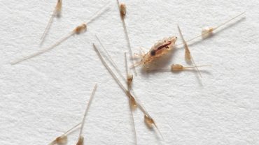 How-to-Get-Rid-of-Lice