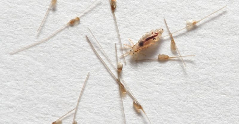 How-to-Get-Rid-of-Lice