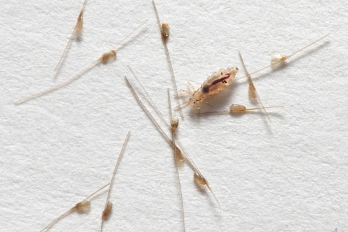 Get Rid of Lice Quickly and Naturally