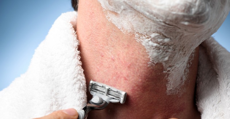 16 Ways to Get Rid of Nasty Razor Bumps or Bikini Bumps