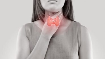 Hypothyroidism-Diet-and-Natural-Treatments