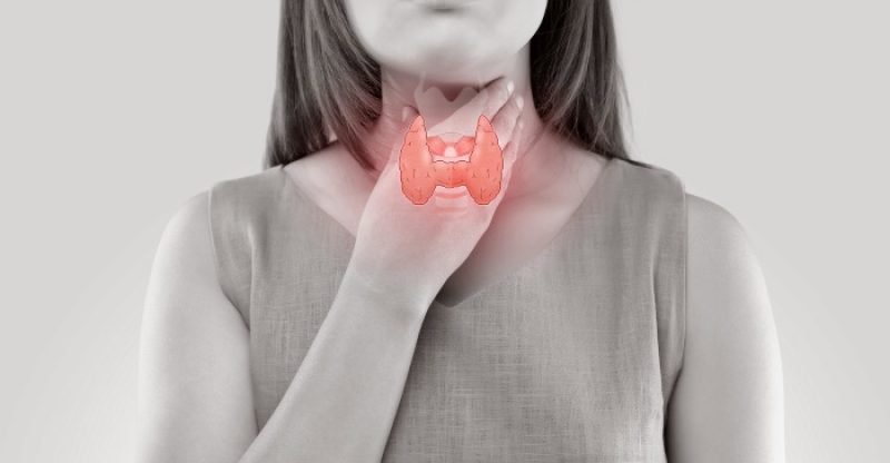Hypothyroidism-Diet-and-Natural-Treatments