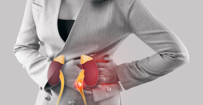 kidney stones causes