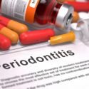 Receding Gums Causes Symptoms and Remedies
