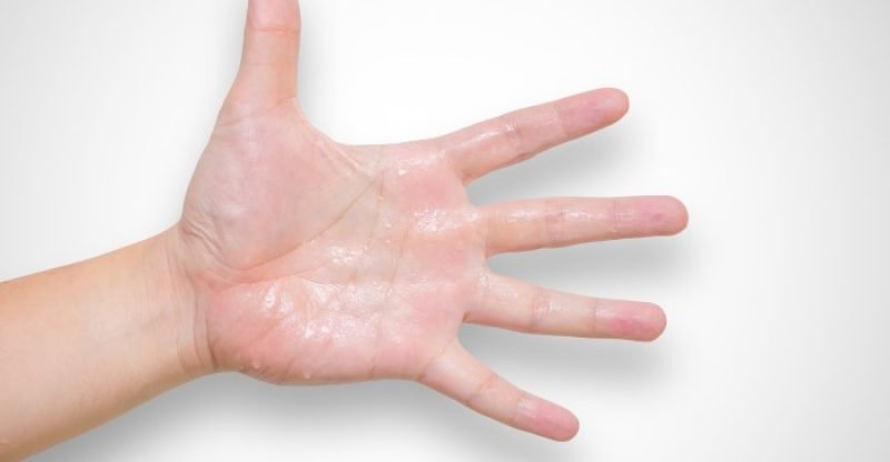 Remedies for Sweaty Hands and Feet 800x416 - 31 REMEDIES VOOR ZWEET HANDEN EN VOETEN