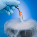sperm-cryopreservation