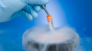 sperm-cryopreservation