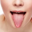 White-Tongue-Causes-and-Natural-Treatments