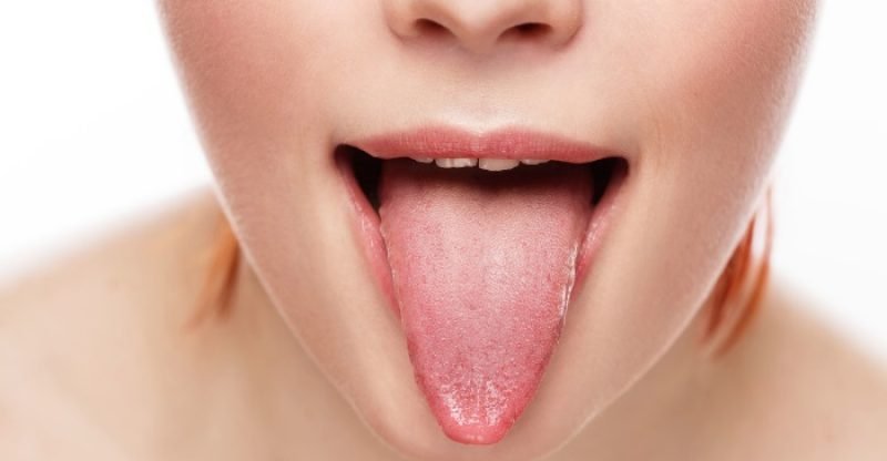 White-Tongue-Causes-and-Natural-Treatments