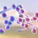 candida-symptoms-treatments-and-remedies