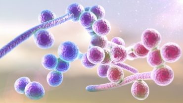 candida-symptoms-treatments-and-remedies