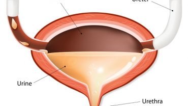 cloudy-urine-issues