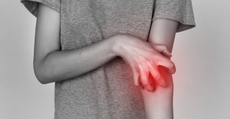 eczema-treatments-and-natural-remedies