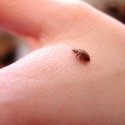 how-to-get-rid-of-bed-bug-bites