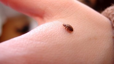 how-to-get-rid-of-bed-bug-bites