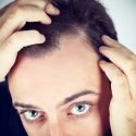 how-to-stop-hair-loss-guide