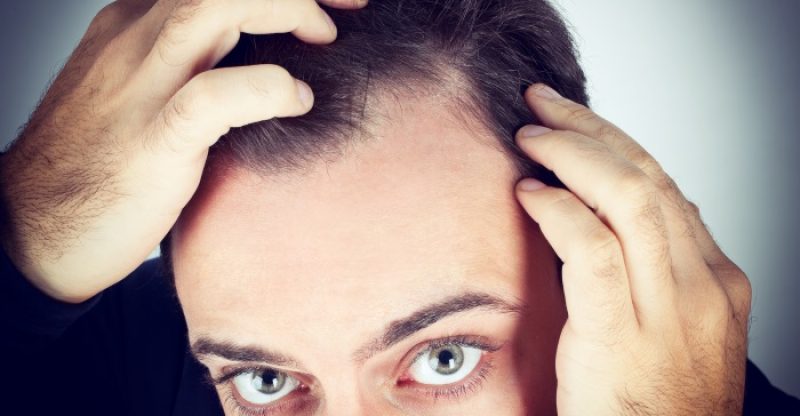 how-to-stop-hair-loss-guide