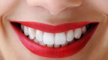 how to whiten teeth naturally