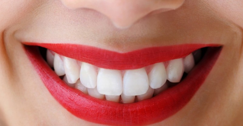 how to whiten teeth naturally