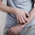 scabies-treatments-symptoms-and-remedies